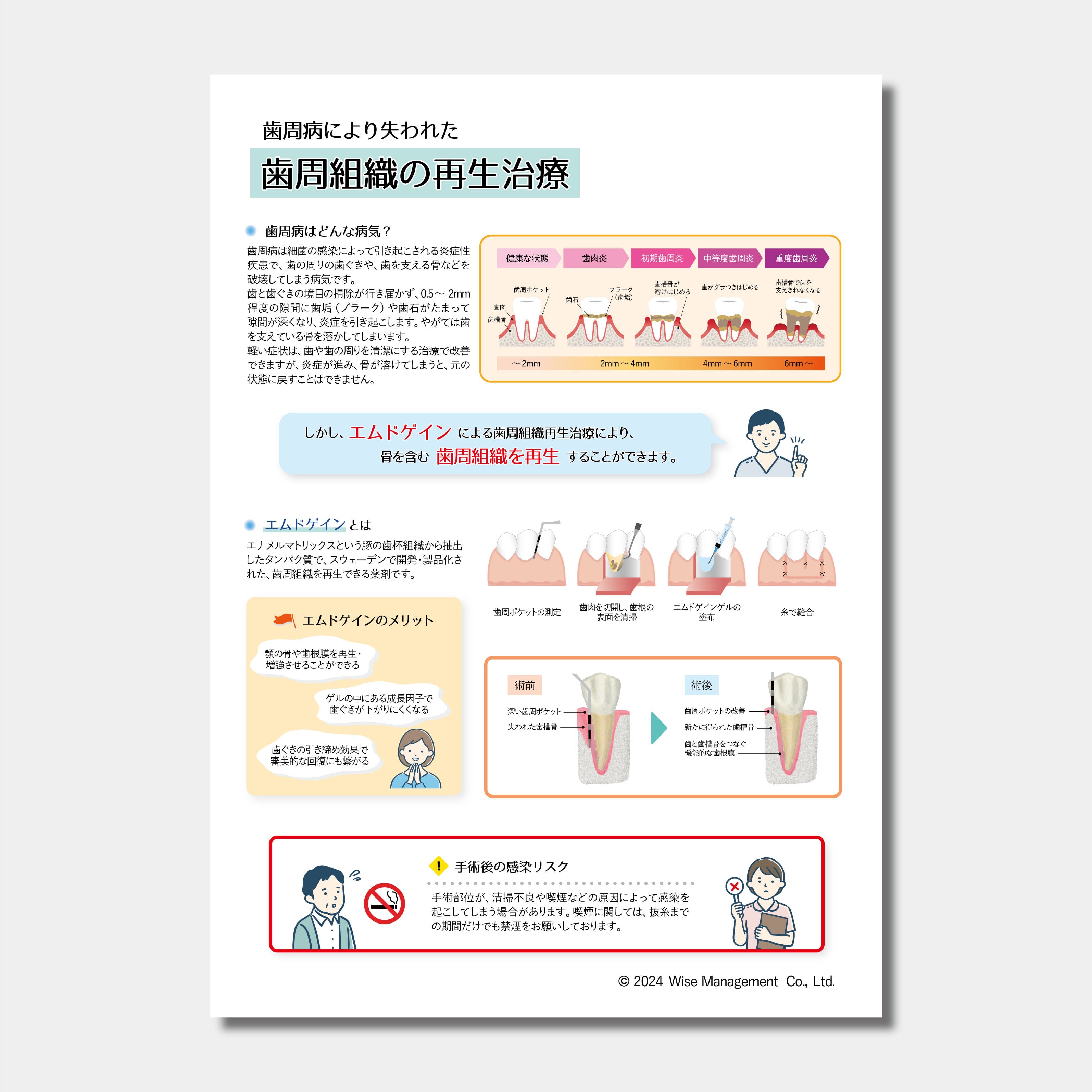 【データ販売】歯周組織の再生治療