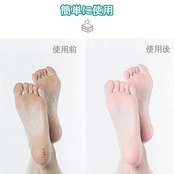 DFsucces 角質削り 魚の目 かかと 角質取り 角質ケア うおのめ 足魚の目 角質除去 替刃10枚付き (シルバー) 1.0 個