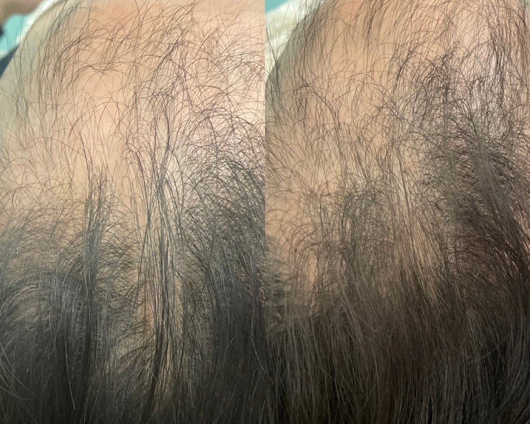 HSC HAIR GROWTH FORMULA ≪養毛剤≫ 強髪スパ ホームケア HSC HAIR GROWTH FORMULA ≪養毛剤≫ 強髪スパ ホームケア