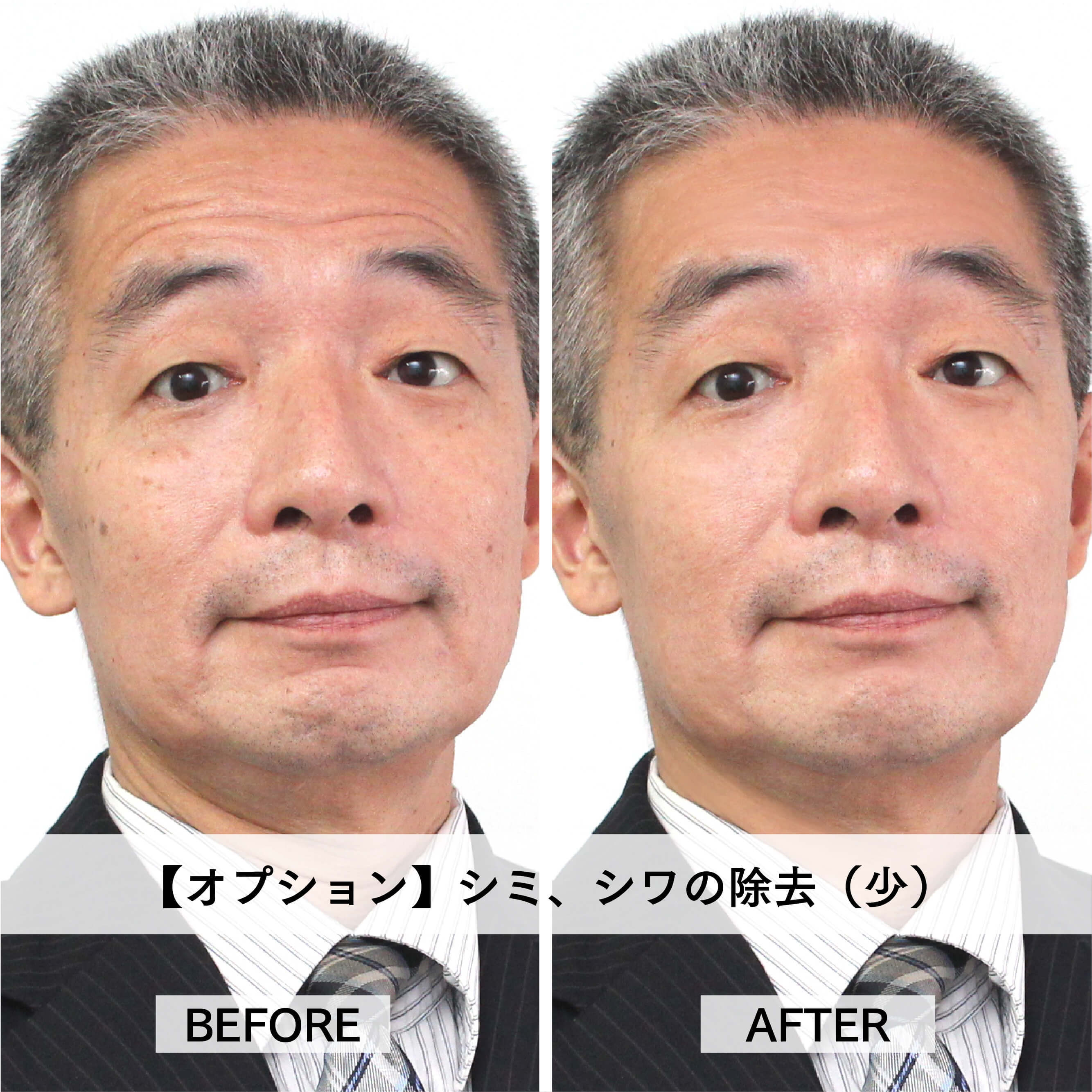 シミ、シワの除去（多）【オプションB】 | プレミアムアートプリント