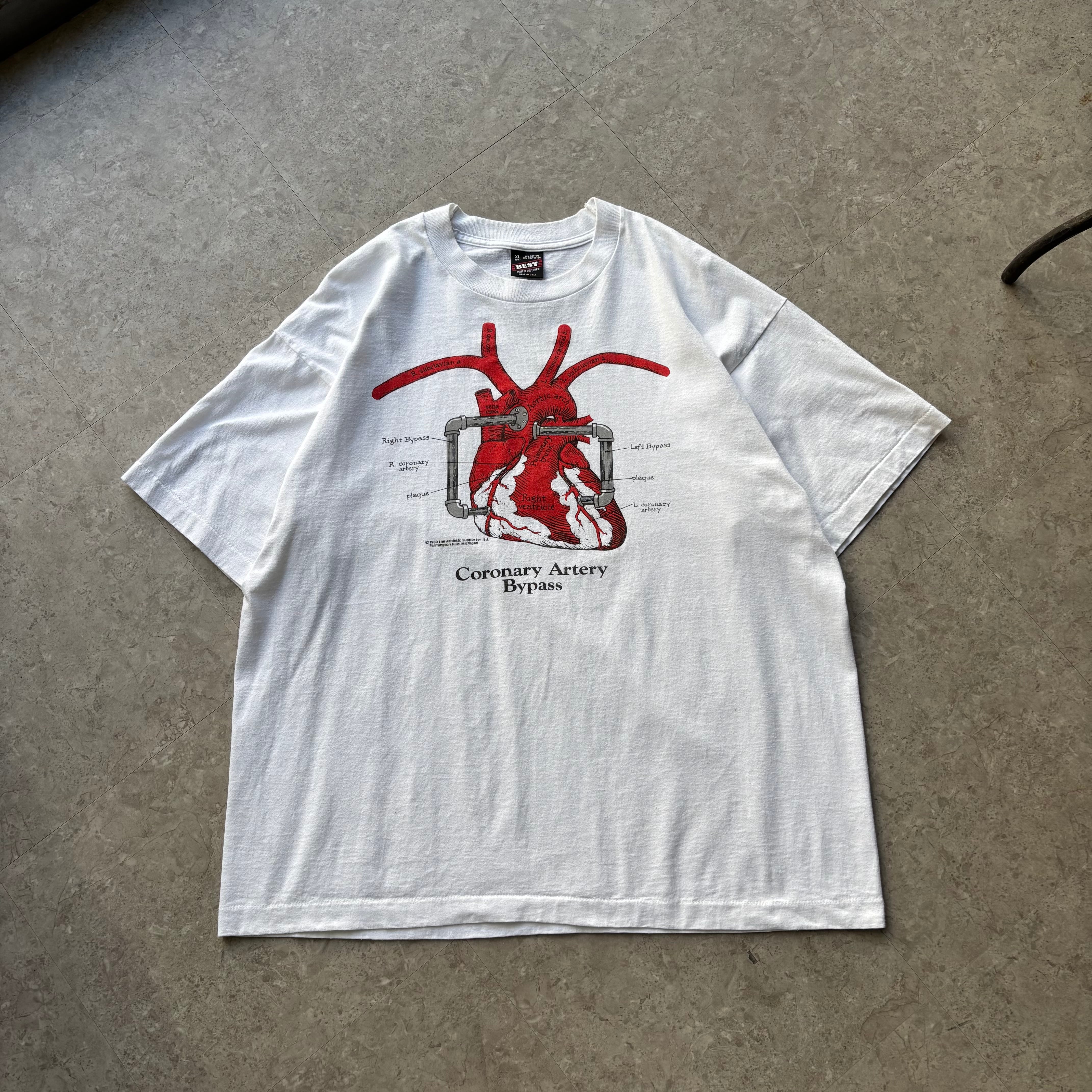 1980s the Athletic Supporter ltd. "Coronary Artery Bypass" anatomical T-shirt【仙台店】