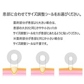 ニチバン フットケア スピール膏CX うおのめ・たこピンポント除去タイプ 直径10mm SPCXN