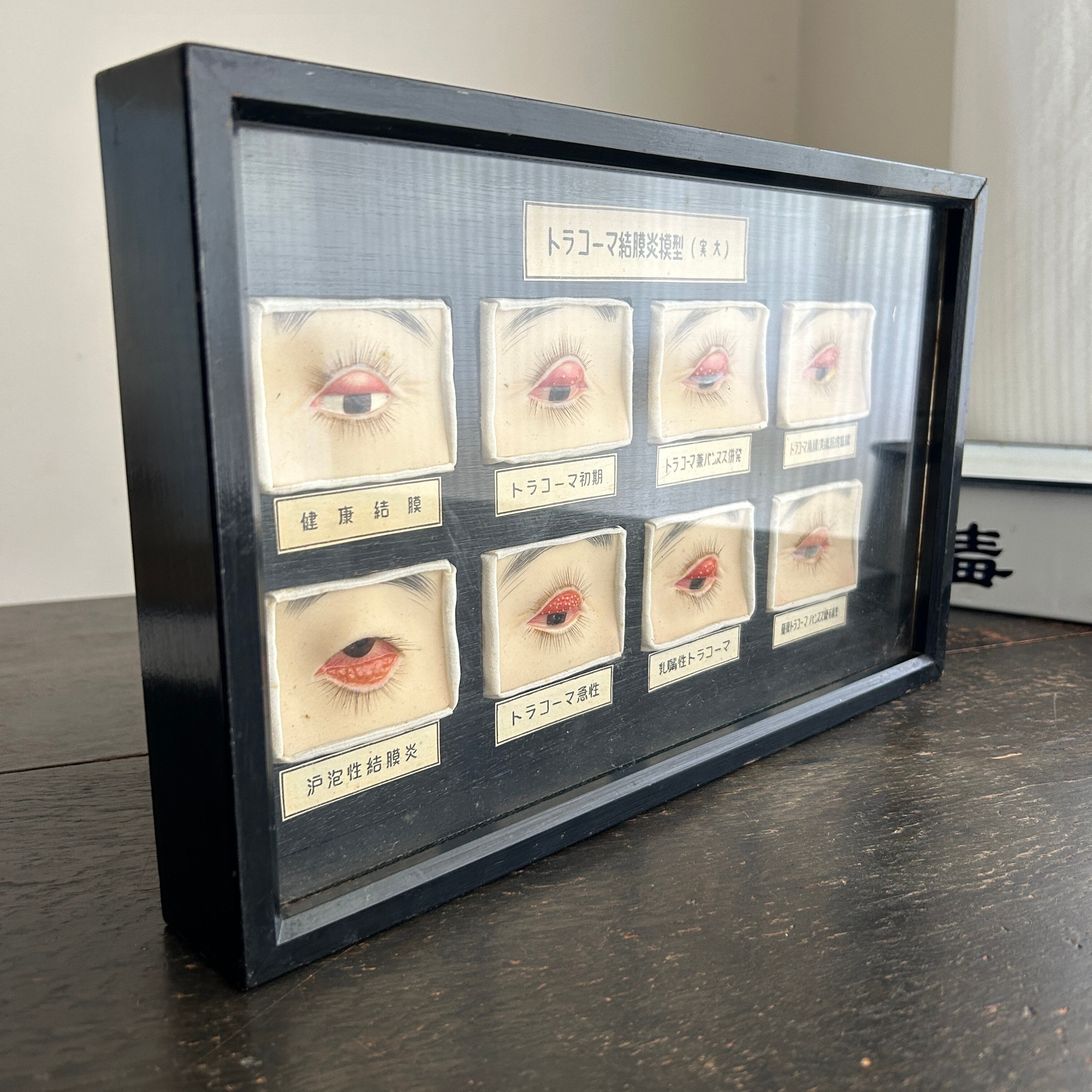 1950年代　眼科用結膜炎模型　