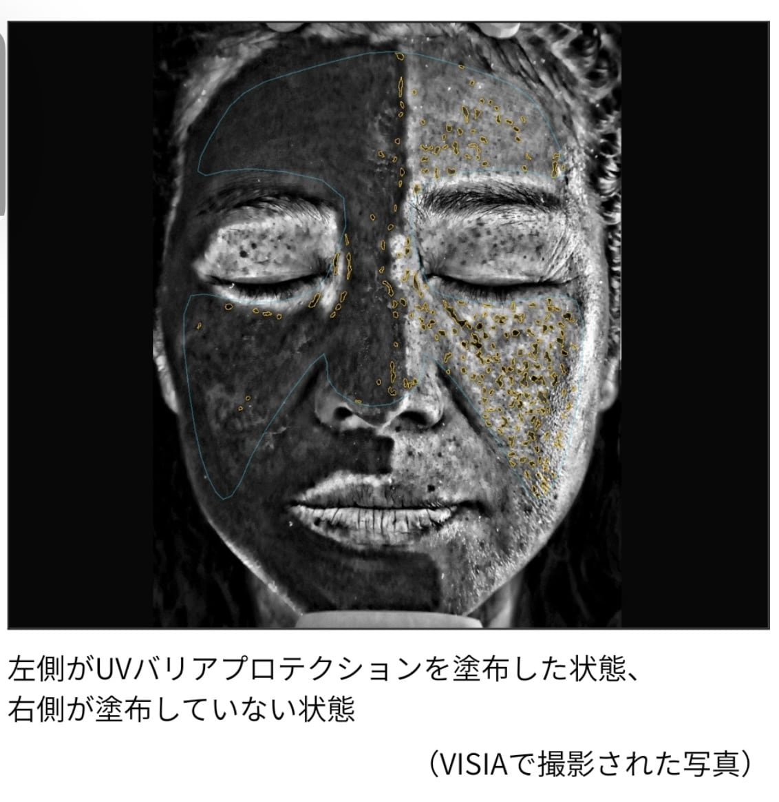 UVシールド バリアプロテクション［リベスキン］ | ONE Bi