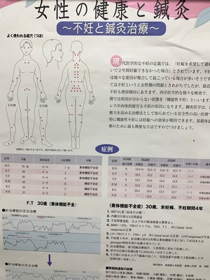 不妊の鍼灸治療ポスター