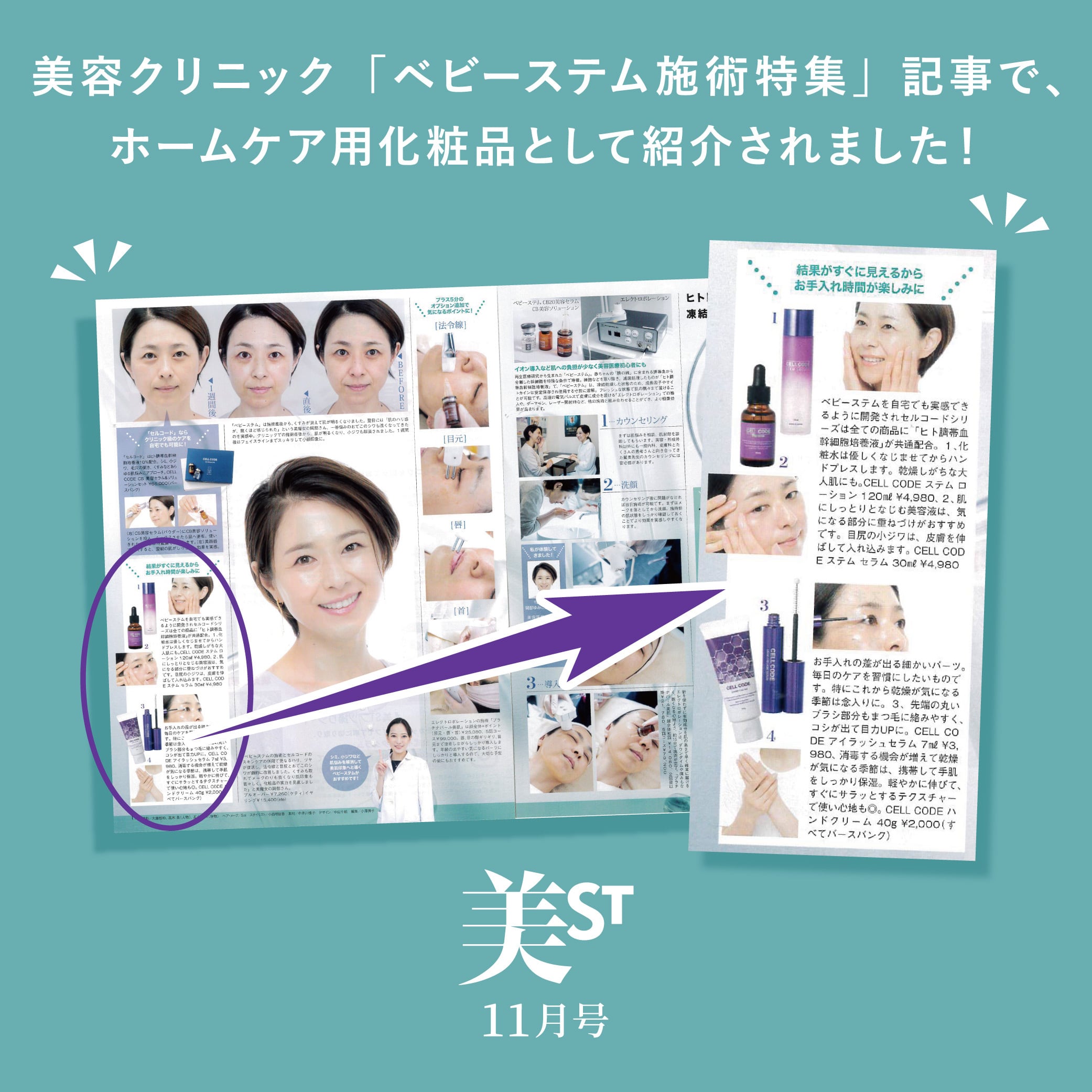 セルコード ベビーステム