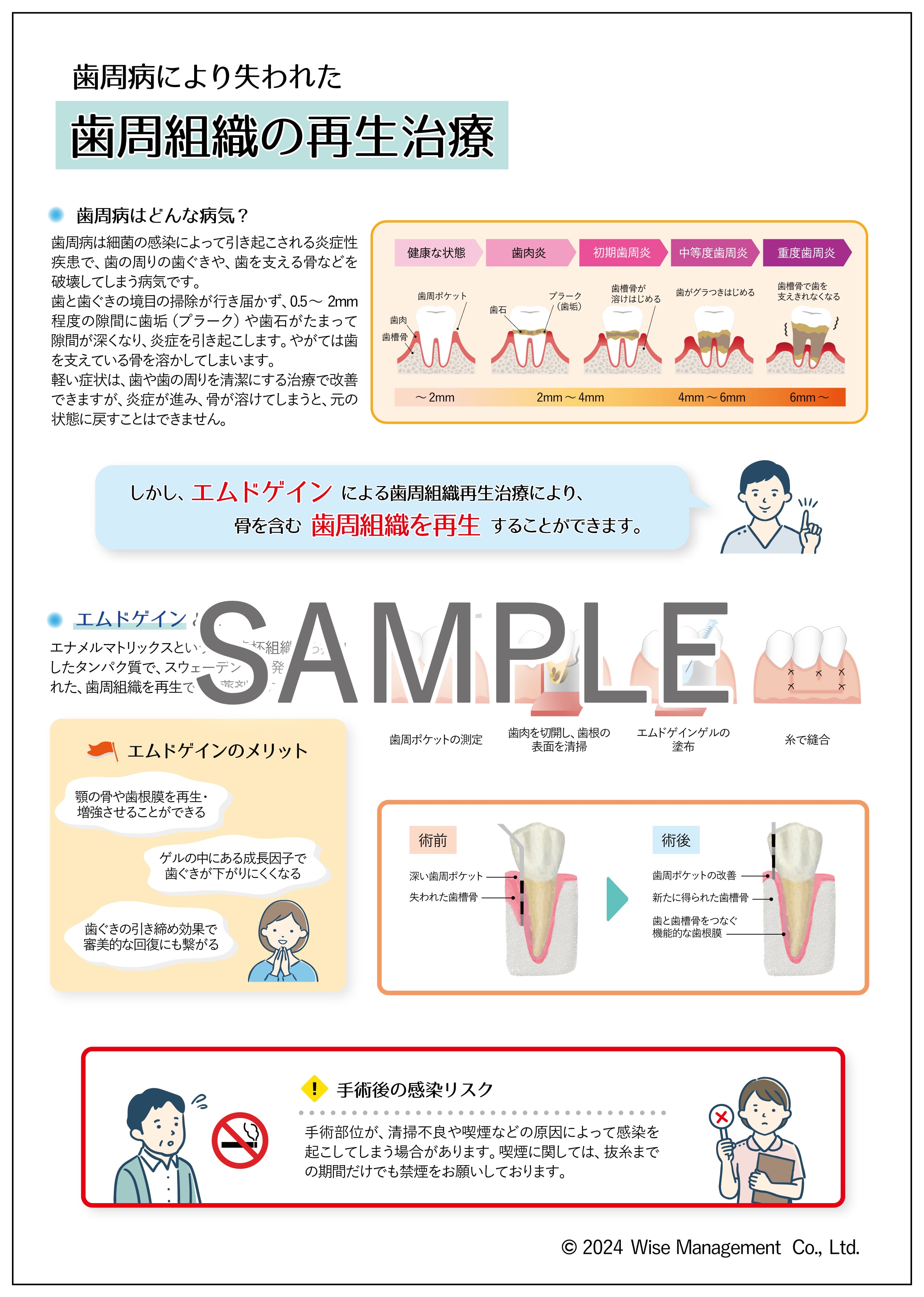 【データ販売】歯周組織の再生治療