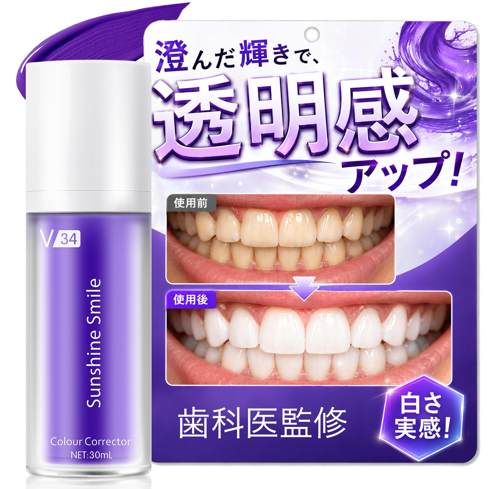 ホワイトニングに最適】マウスオープナー/オーラルワイダー/歯科