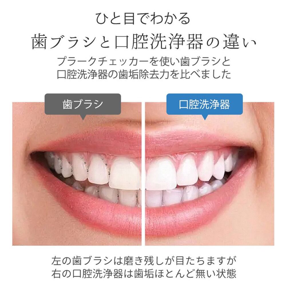 ○99.9%以上歯垢除去力口腔洗浄器クリーニング