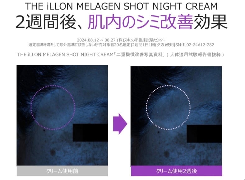 メラゲンショットナイトクリーム《肝斑・シミ・そばかす