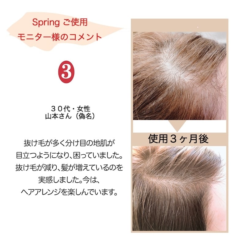 発毛促進 育毛 薄毛 抜け毛 育毛剤 医薬部外品 ボタニカル 無香料