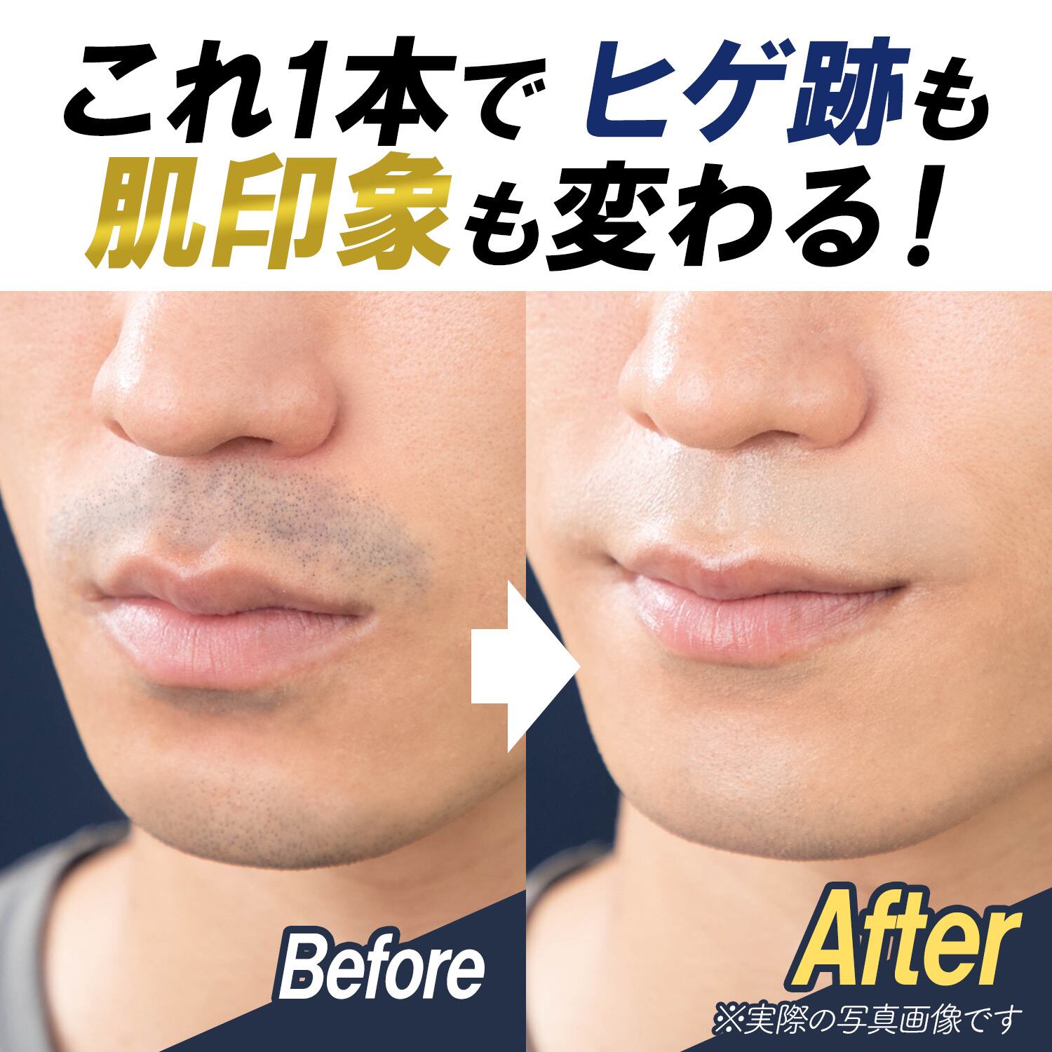 クラッセ【ひげ隠しコンシーラー ディシェイド】男装 コスプレ 青ひげ