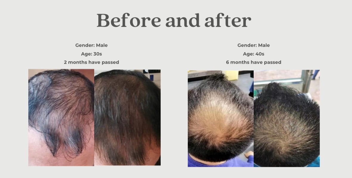 ReVive Scalp Mist (スカルプミスト) | facial salon RAPPORT / LAÉSSE