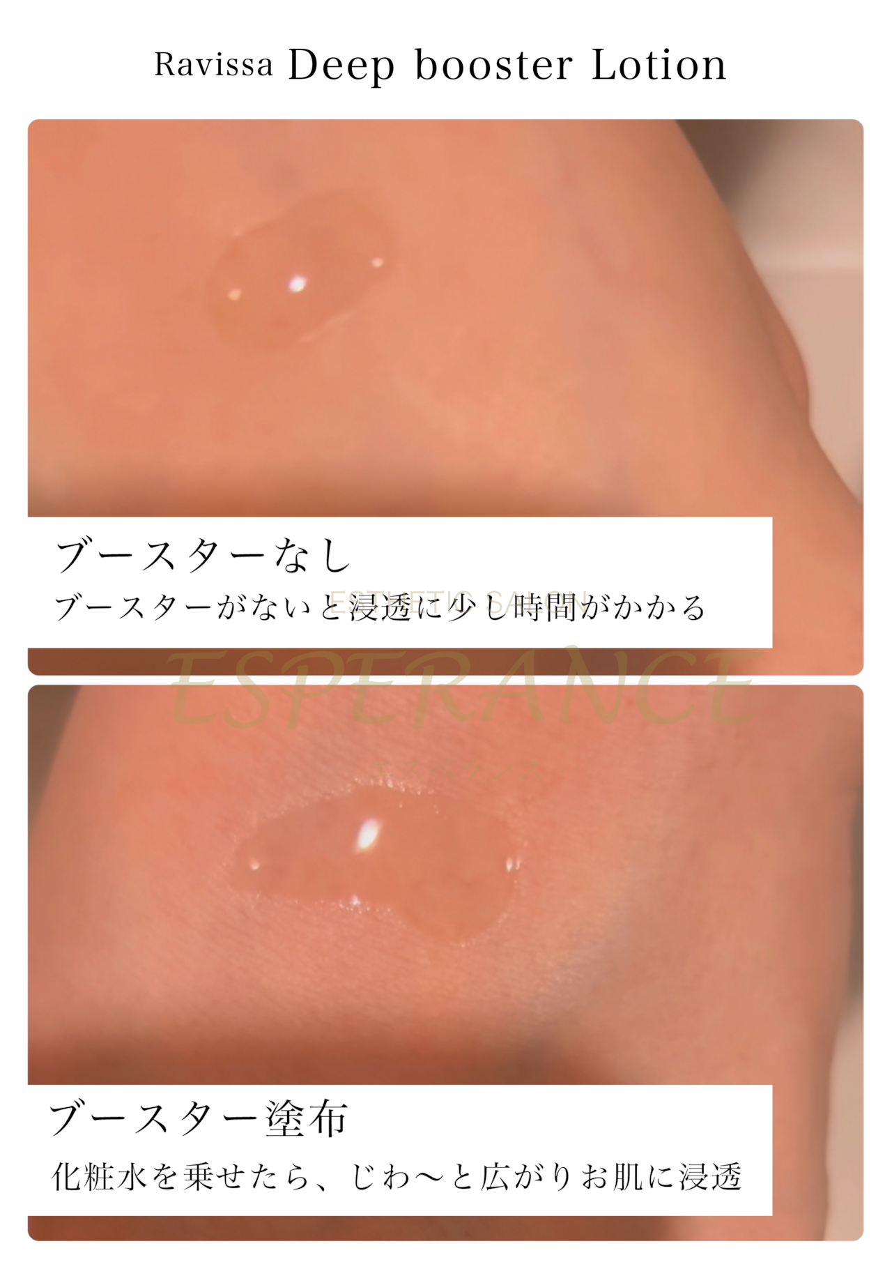 ☆Ravissa / ディープブースターローション〈浸透型化粧水 ☆Ravissa / ディープブースターローション〈浸透型化粧水