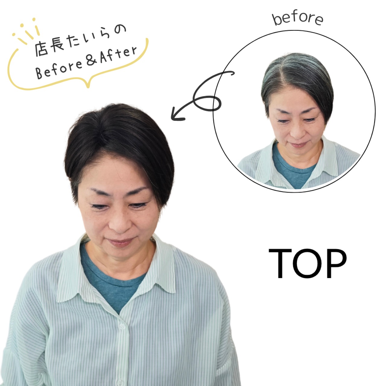 【医療用ウィッグ】 人毛100％ トップふんわりピース 部分ウィッグ 自然な仕上がり 薄毛ボリュームアップ【4×9cm】 |フル卒 部分ウィッグ エアリー感覚