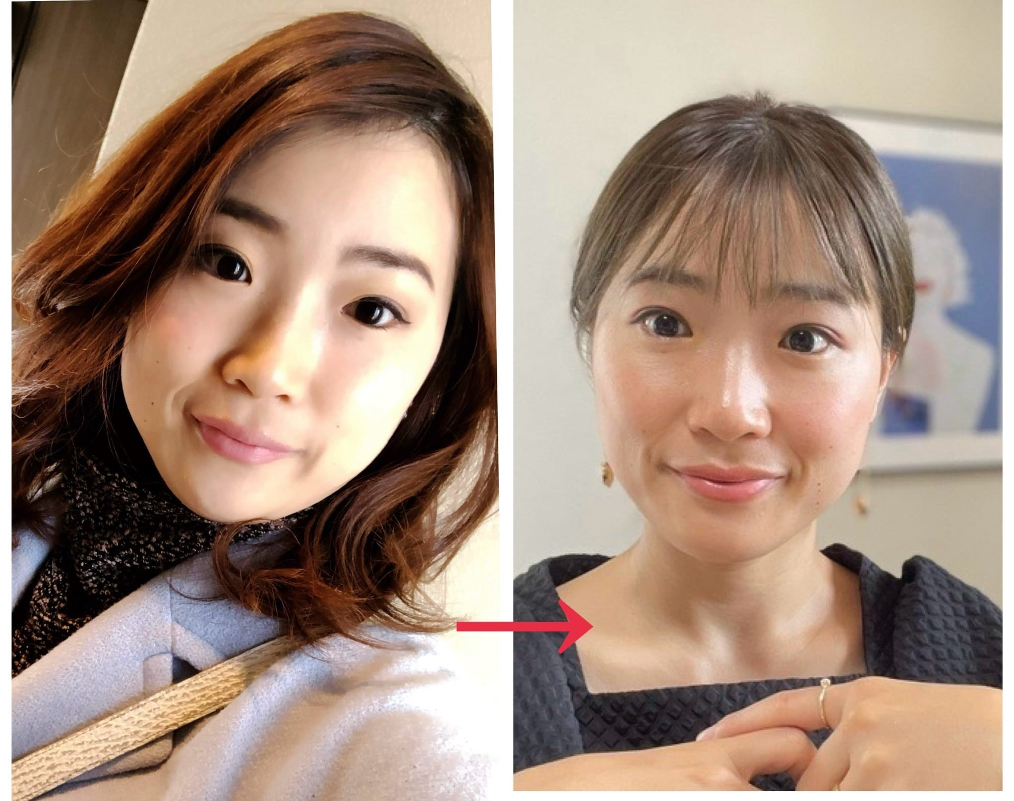 痩せた？」と言われるAI美顔器パイラナイト | PAY ID