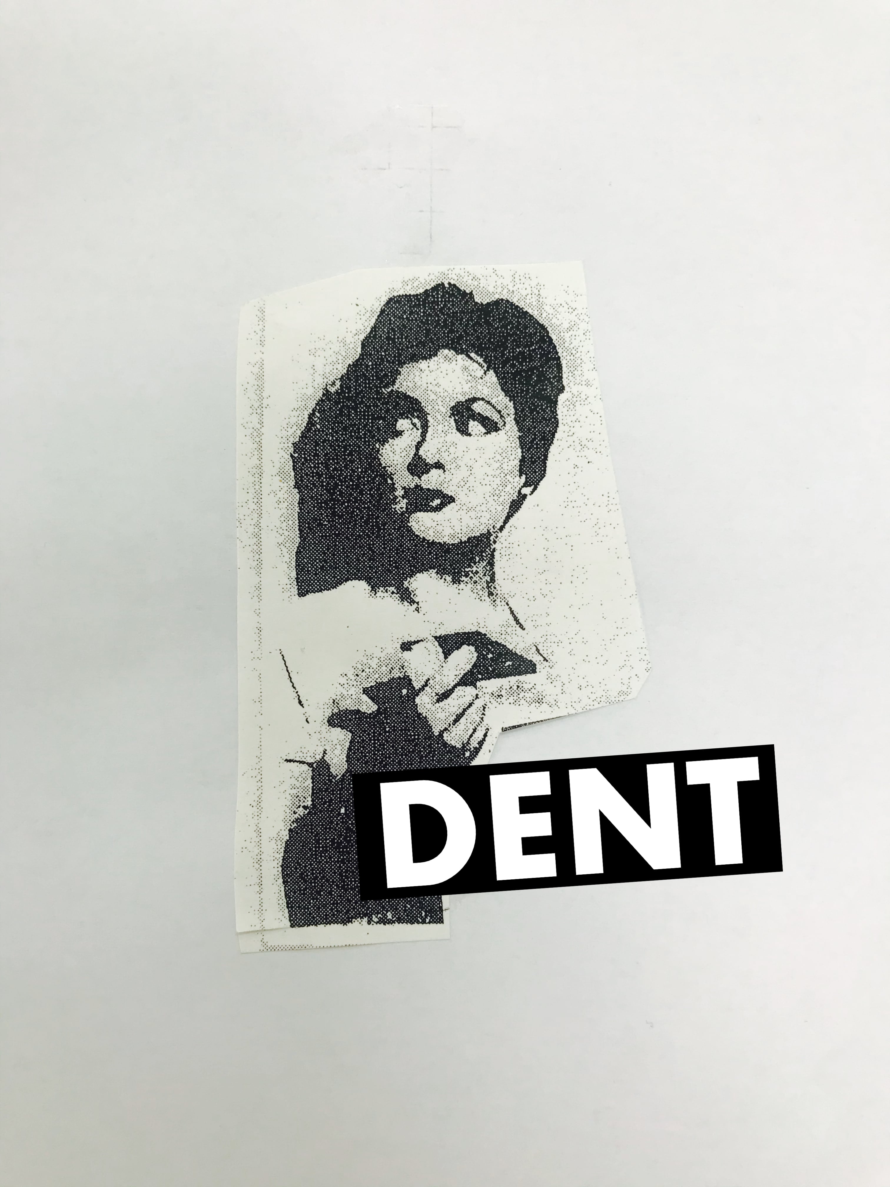 DENT