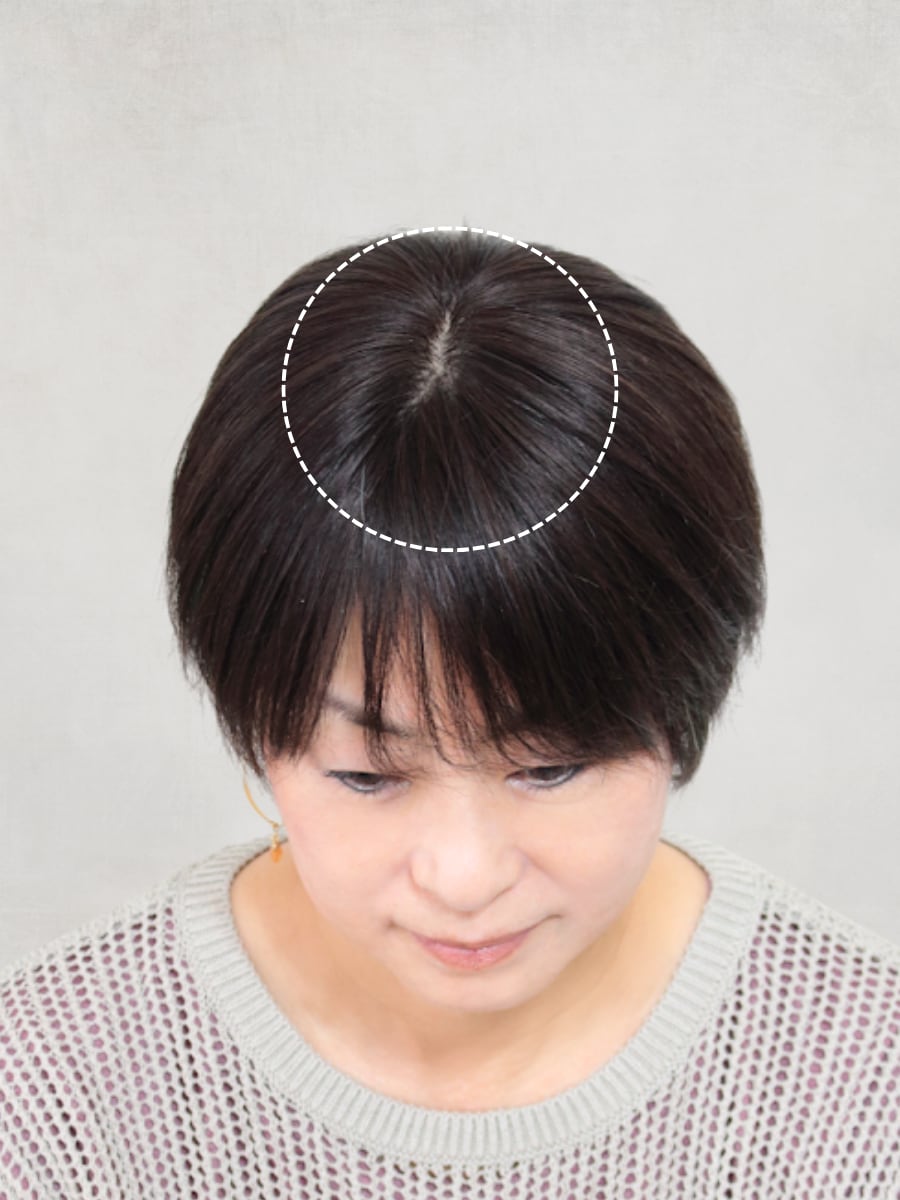 全体的な毛量の減少