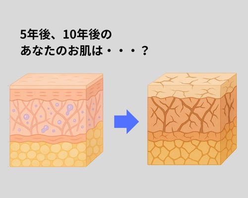 5年後、10年後の、あなたのお肌は・・・？