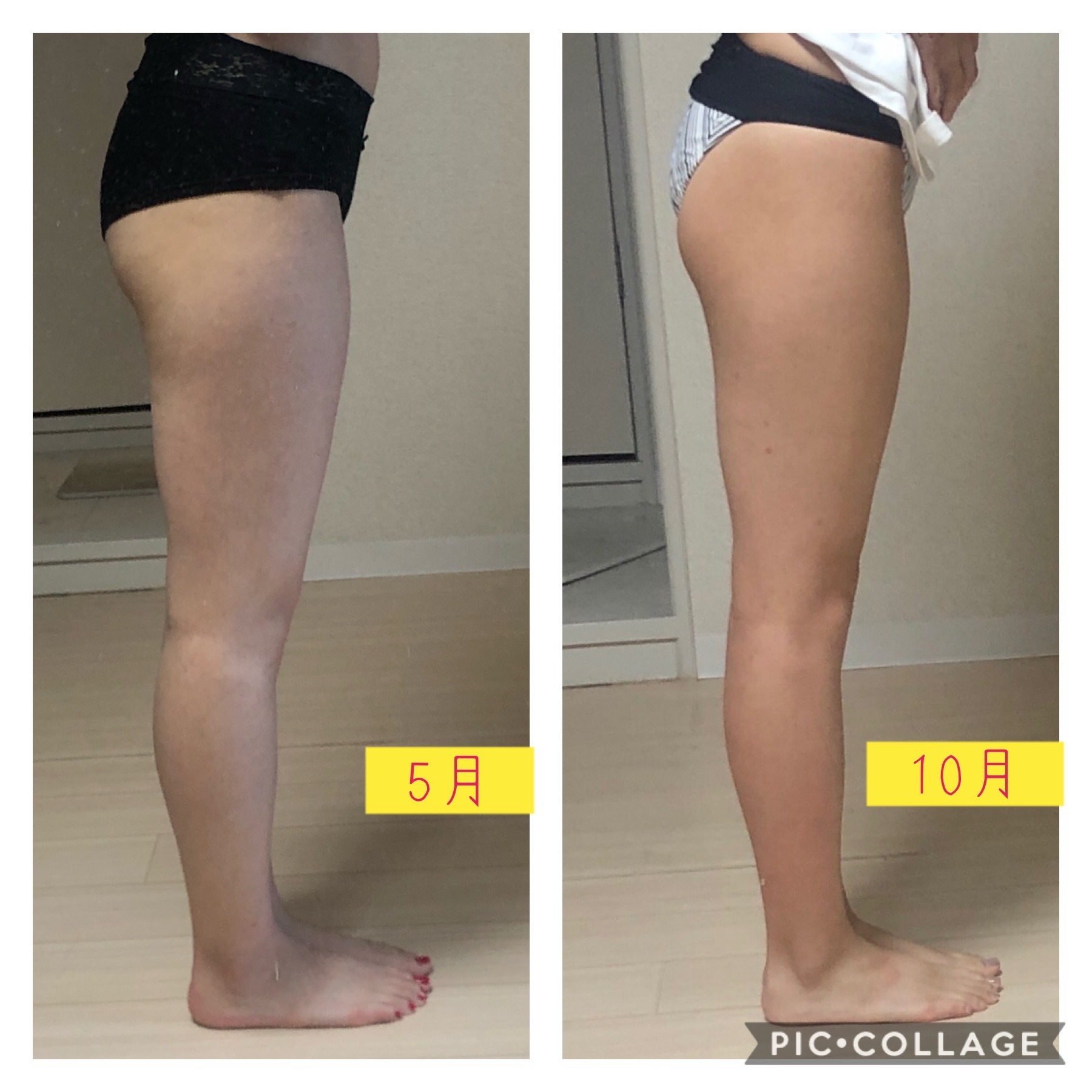 キャビテーションダイエットビフォーアフター 下半身痩せに私がした事 Chanstore 美容機器販売